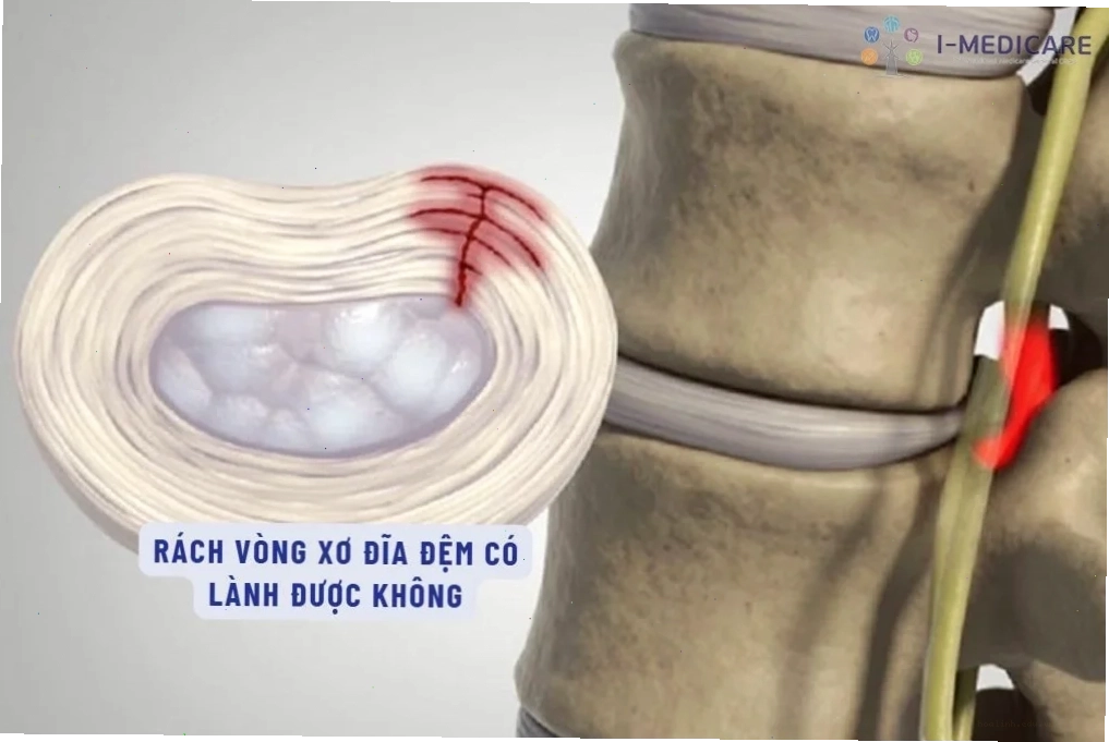 Áo dài trong đời thường