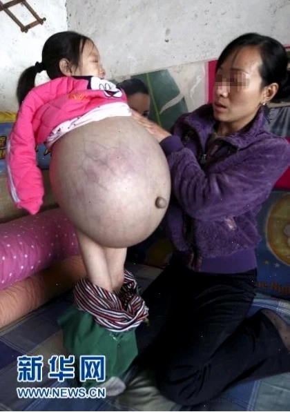 Cô gái ăn rau xanh