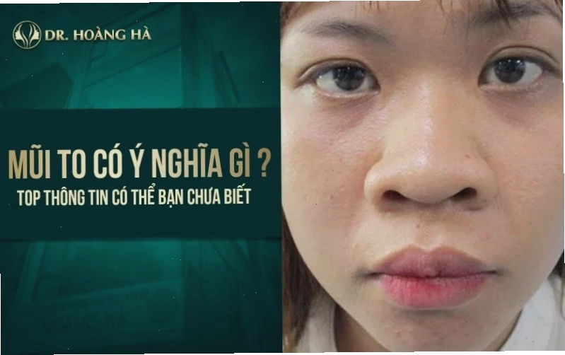 con gái có cánh mũi to dạo phố