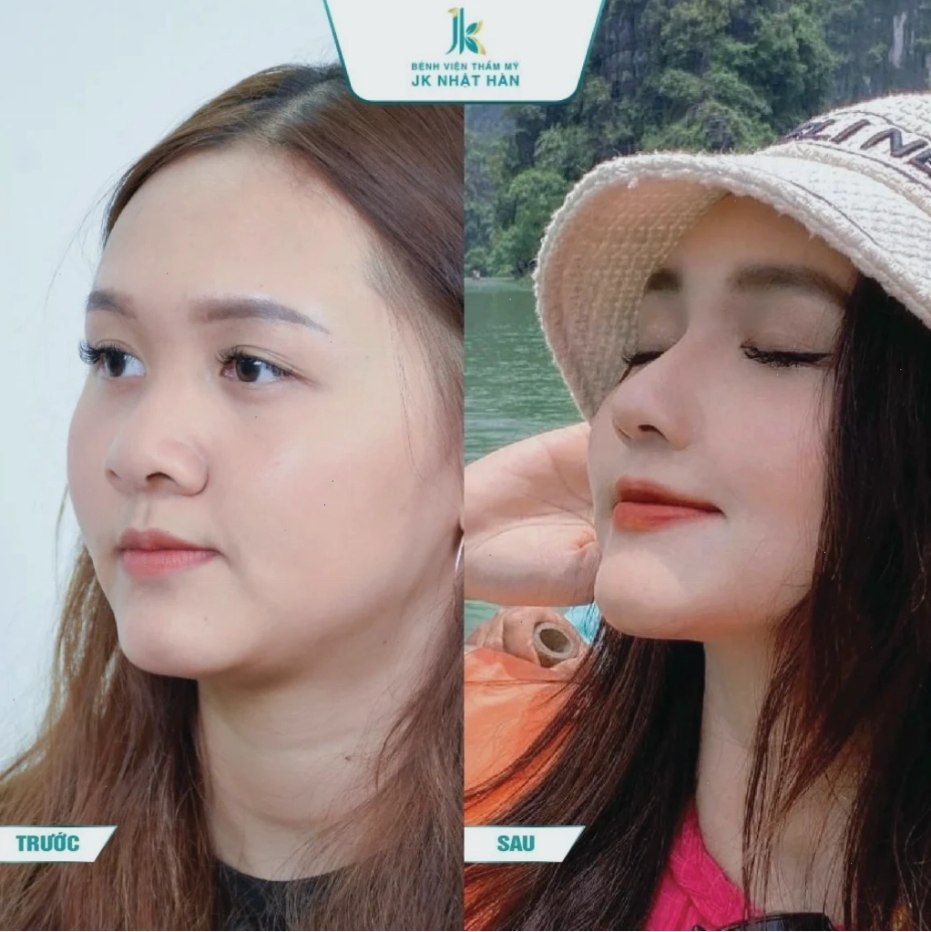 con gái có cánh mũi to dạo phố cuối tuần