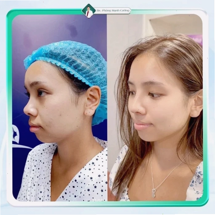 con gái có cánh mũi to du lịch