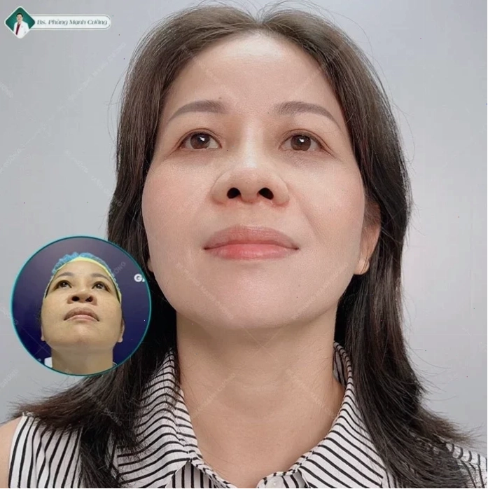 con gái có cánh mũi to năng động