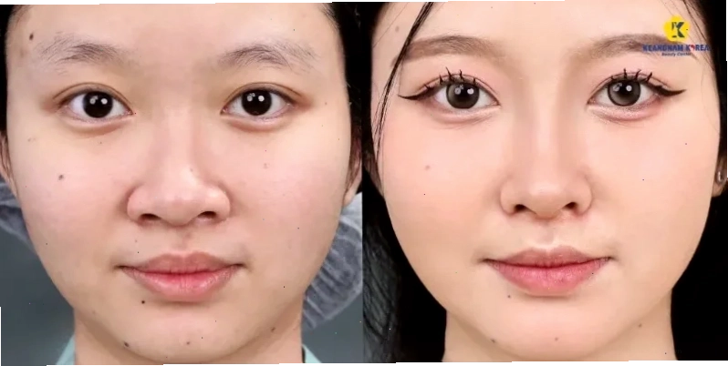 con gái có cánh mũi to phối đồ