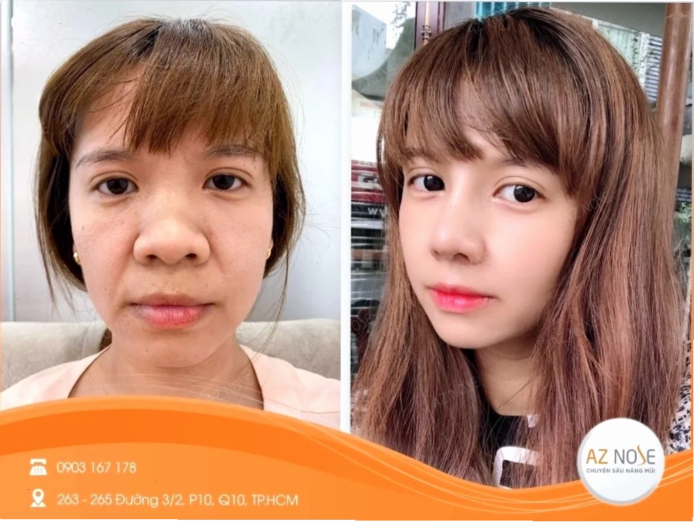 con gái có cánh mũi to trong công việc