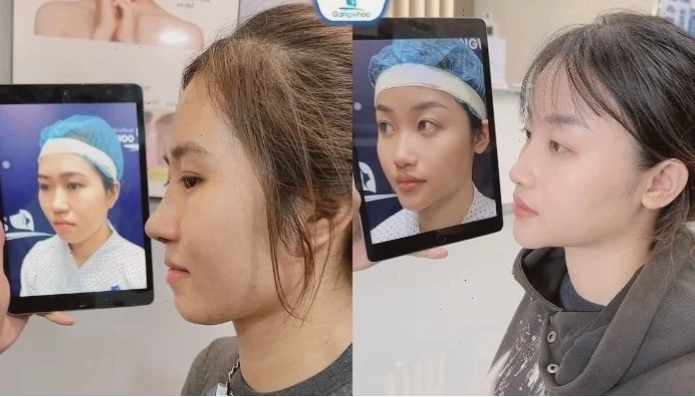 con gái có cánh mũi to uống trà