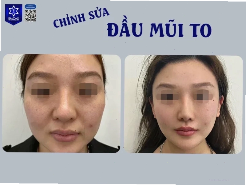 con gái có cánh mũi to và sự tự tin
