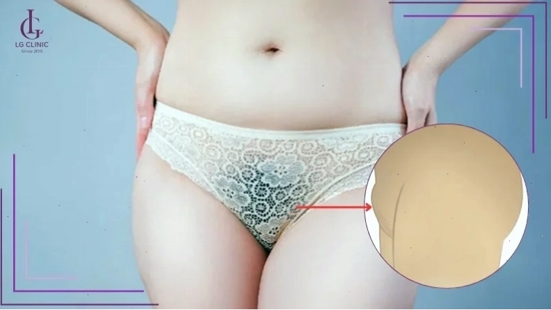 con gái có mu to đi khám sức khỏe