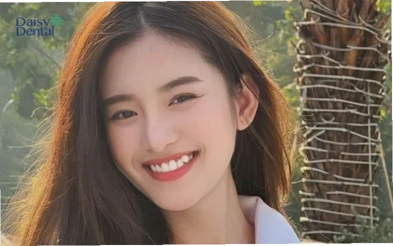 con gái có răng cửa to ấn tượng