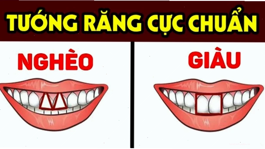 con gái có răng cửa to cười tươi