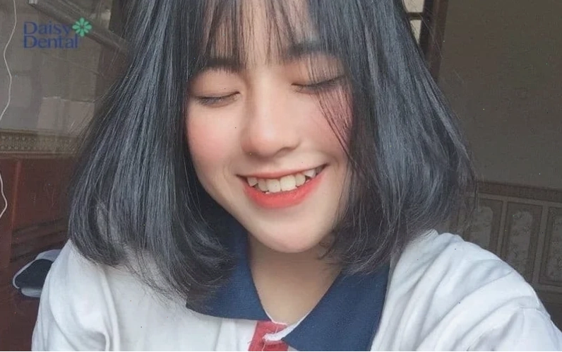 con gái có răng cửa to cười xinh