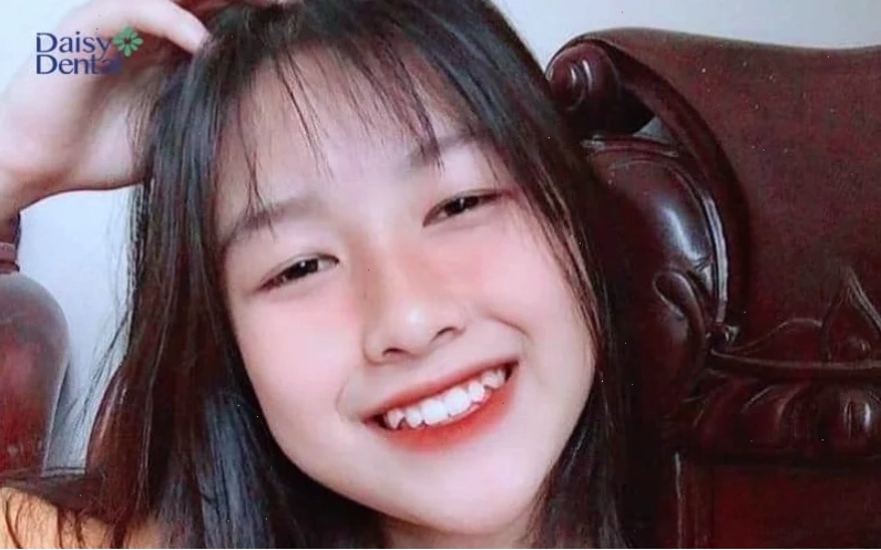 con gái có răng cửa to cười xinh