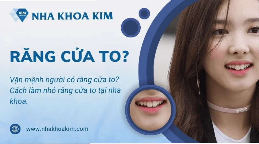 con gái có răng cửa to nổi bật