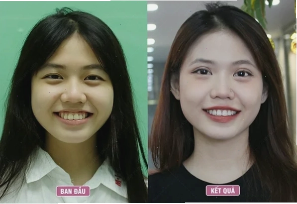 con gái có răng cửa to rạng rỡ