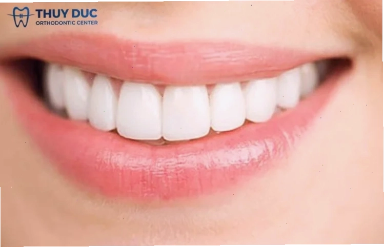 con gái có răng cửa to trong đời thường