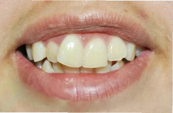 con gái có răng cửa to tự tin