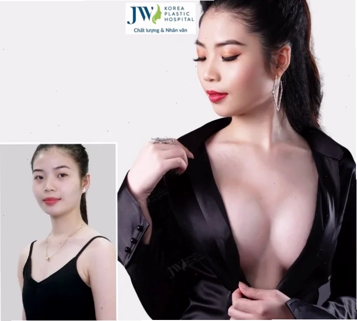 Góc nhìn hoàn mỹ Góc nghiêng em gái ngực to