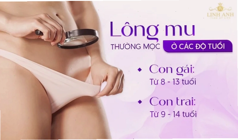 Lời khuyên sức khỏe con gái mu to thì sao