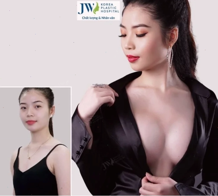 những cô gái tí to mặc váy