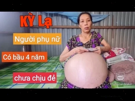 Tình trạng bụng dưới to