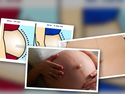 Sự thật về bụng bầu to là con trai hay gái khó tin