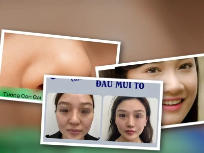 Sự thật về tướng số con gái có cánh mũi to ít ai biết